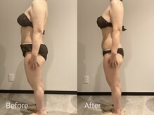 エステティック ミュー(Esthetic MiEUX)/全身痩せ、ダイエット