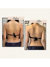 ザ レディービー(The Lady B)/ブライダルエステ