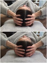 カルペード 中百舌鳥/なかもず院(Carpe D.)/施術後の変化