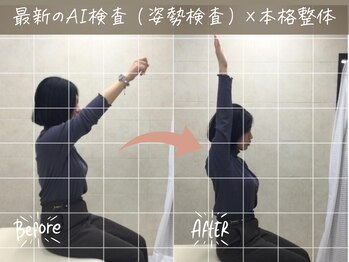 ナオル整体 町田院(NAORU整体)/before/after【2】 町田/整体