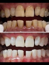 ハモットホワイト(Hamotto White)/照射10日目☆