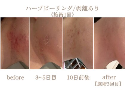 アムールドゥ 麻布十番(Amour deux)の写真