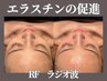 超音波でマルチケア☆水玉リフティング☆LDM＋RFラジオ波¥11000→￥7700