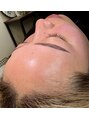 エレナビューティー(Elena Beauty)&nbsp;フェイスワックス後はつるんとたまご肌♪