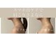 エステスタジオ アキコ(AKIKO)の写真