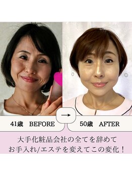 ポムポムボナー/オーナーも改善しました♪