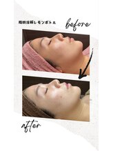 ベル(Belle)/脂肪分解レモンボトル