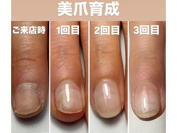 フェアリーヘア ニーナ(Fairy Hair Ni-na)/パラジェル美爪育成ネイルケア