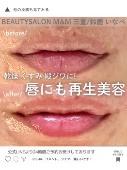 エムアンドエム(M&M)/