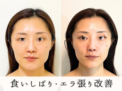 ジョンミー(JONMEE)の写真