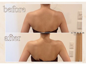 アンバー 恵比寿(AMBER)/ドレス映え、ブライダル