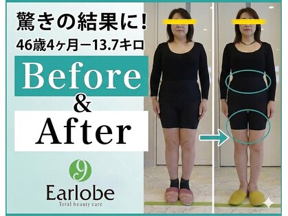 耳つぼアンドスリムケア イヤローブ(Earlobe)の写真