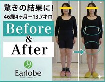 耳つぼアンドスリムケア イヤローブ(Earlobe)