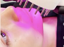 シャリテ(Charite)