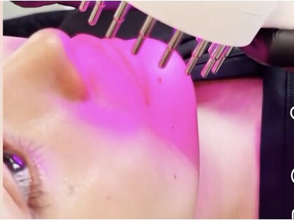 シャリテ(Charite)の写真