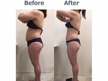 ニカ(NIKA)の雰囲気（最強痩身マシン3step落ちない脂肪を分解。ちゃんとやれば効果大）