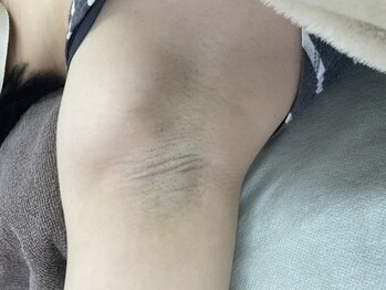 ナノハナ/鹿沼市全身脱毛美容室ナノハナ