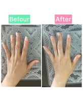 桃の木 吉祥寺店/40代女性これだけ印象が違います