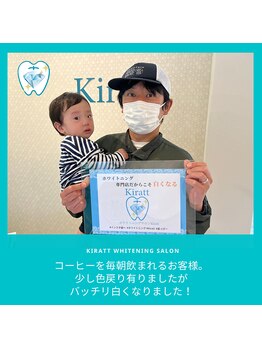 キラット 高知中万々店(Kiratt)/【クリスタルホワイトニング】