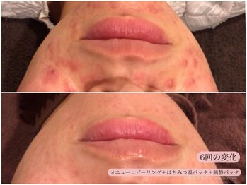 レスイズモア 恵比寿(less is more.)/6回の変化