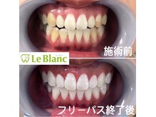 ルブラン 奈良店(Le Blanc)/大変身(^ ^)