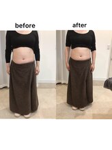 ジョワイユ(Joyeux)/腸の位置でお腹は変わる