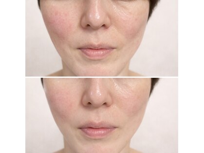 ラシクビューティールームの写真