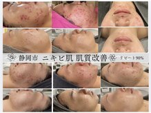 ビューティーブルーム(BeautyBloom)