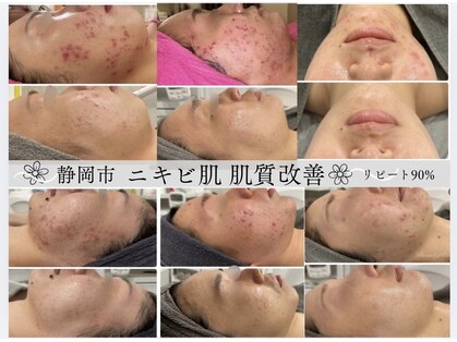 ビューティーブルーム(BeautyBloom)の写真