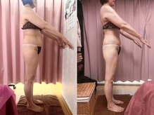 美容整体カラダリメイク(karada)/骨盤矯正ダイエットの結果