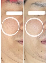 エステサロンパリス(Esthe Salon Paris)/男性のお肌もお任せください