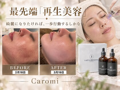 カロミ(Caromi)の写真