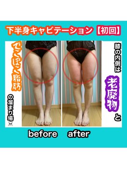 ビューティ ウィッチ(Beauty Witch)/