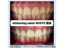 ホワイトニングサロン ホワイト(WHITE)/セルフホワイトニング/大阪/福島