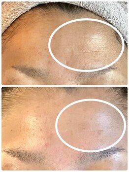 エステティックジュビラン アンビエンテ 福井南店/乾燥改善