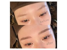 モカラ(MOKARA)/ビフォーアフター