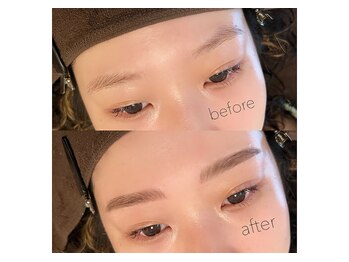 モカラ(MOKARA)/ビフォーアフター