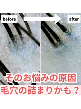 サロンドミヤシタ(SALON DE MIYASHITA)/抜け毛の予防に効果的