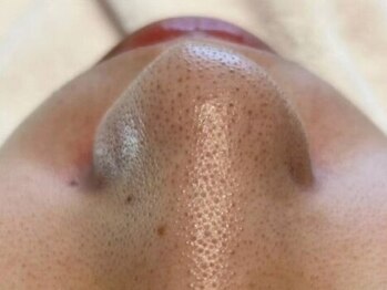 ラデュープラス(Radieux+)の写真/《男性の方も大歓迎》メンズ◇韓国式３D毛穴洗浄¥12800*気になる毛穴の黒ずみ・汚れをしっかり洗浄★高円寺
