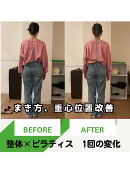 そらまめ接骨院/スカイビーンズ(SkyBeans)/まき肩、評価