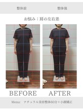 ヨギート(yogate)/整体/小顔/リンパマッサージ