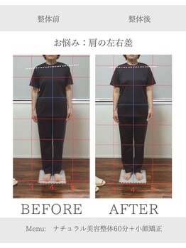 ヨギート(yogate)/整体/小顔/リンパマッサージ