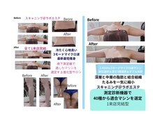 スキャニング@ラボエステ