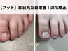 【深爪/噛み爪】即日見た目改善！フット深爪矯正初回お試し