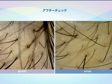 アンス(anth:)/お客様の仕上がり