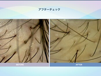 アンス(anth:)/お客様の仕上がり