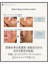 チェスタ/ホワイトスノーピール