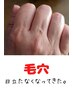 ☆毛穴洗浄リピータ様☆8000円