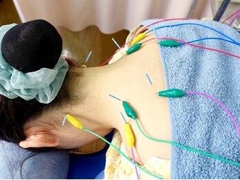 富山ふじい鍼灸整体院の写真/富山市【大泉駅】の経験豊富な鍼灸師在籍◎多くのお悩みに寄り添ってきたからできる!リピ多数の鍼灸施術☆