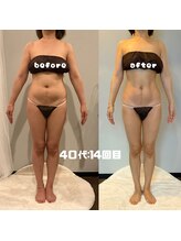 ソウソウビューティー 五反田(Shou Shou Beauty)/ビフォー★アフター　14回目